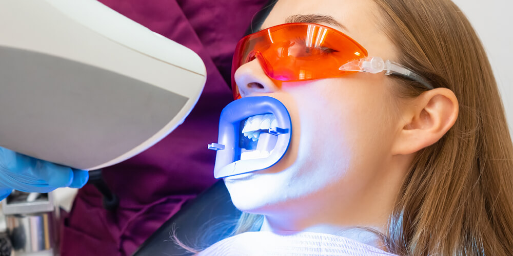 Teeth Whitening Oakville