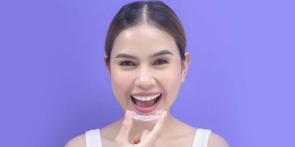 Benefits of Invisalign for Straightening Your Smile